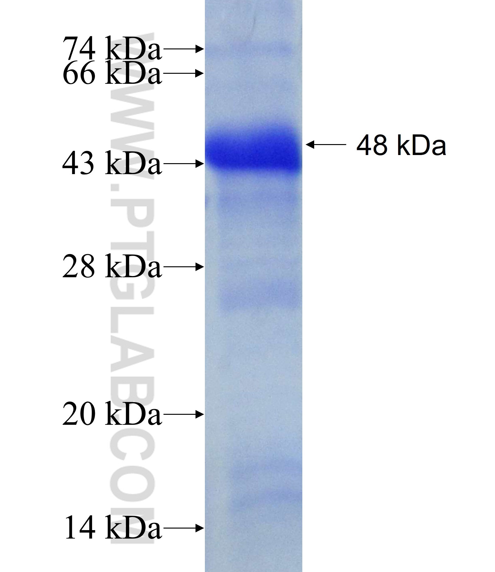 TRPM4 fusion protein Ag17687 SDS-PAGE