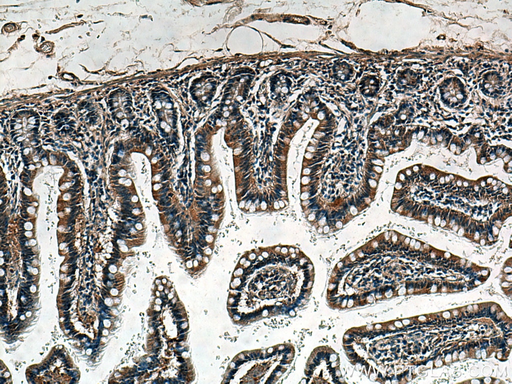 Immunohistochemistry (IHC) staining of human small intestine tissue using TRPM5 Polyclonal antibody (18027-1-AP)