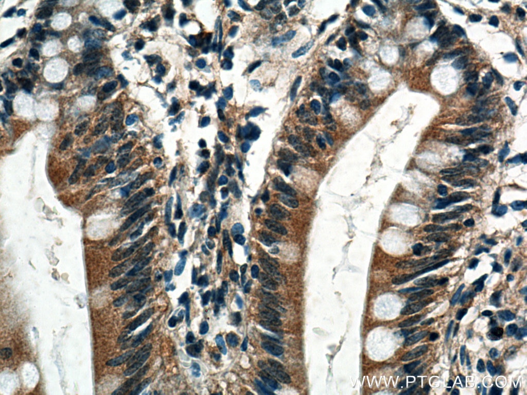 Immunohistochemistry (IHC) staining of human small intestine tissue using TRPM5 Polyclonal antibody (18027-1-AP)