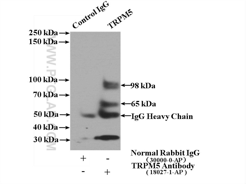 TRPM5