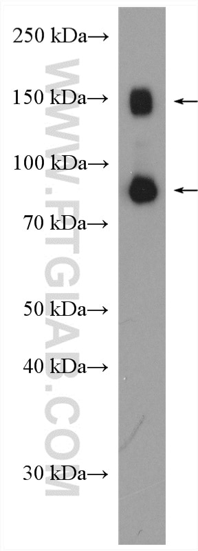 Western Blot (WB) analysis of mouse liver tissue using TRPM5 Polyclonal antibody (18027-1-AP)