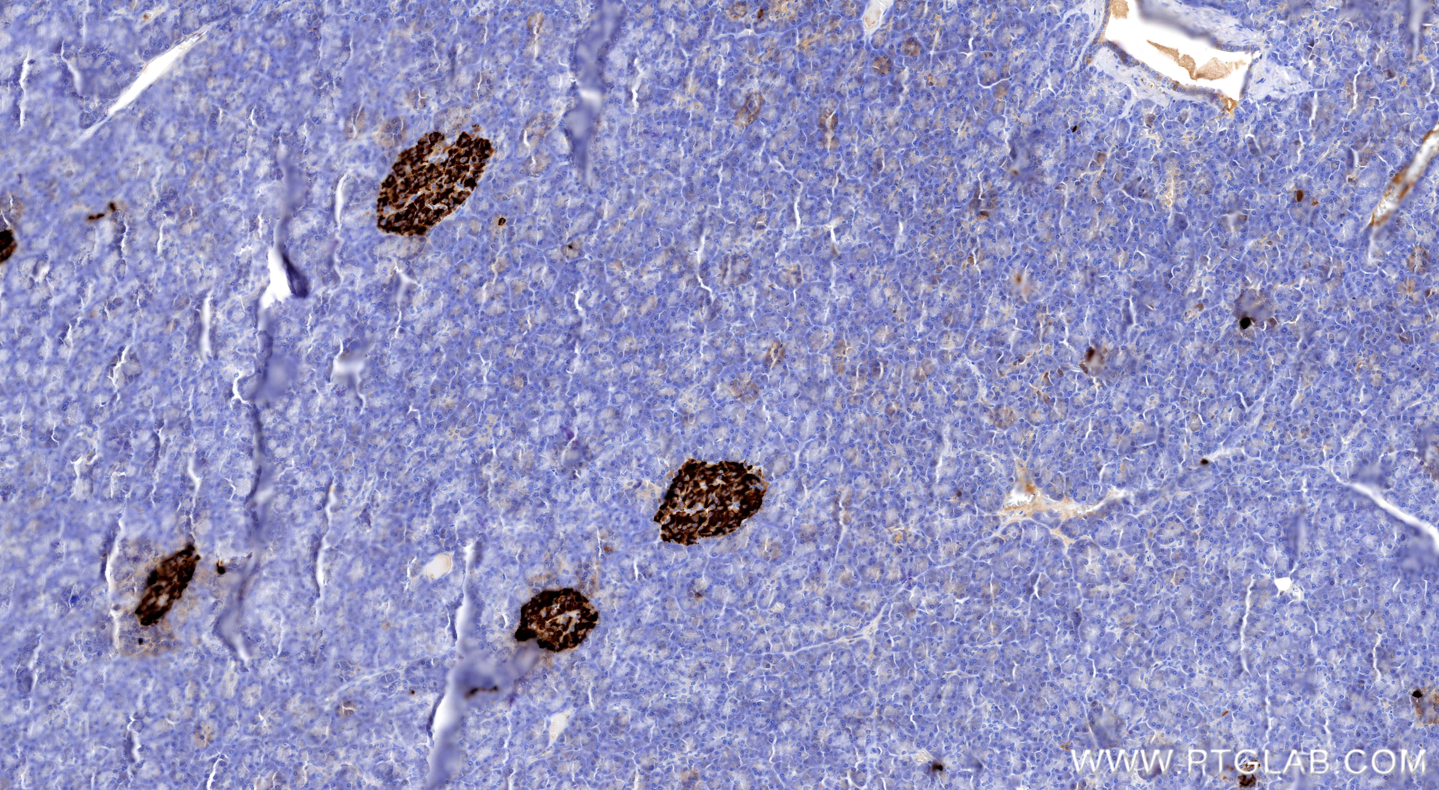 IHC staining of human pancreas using 98691-2-RR (same clone as 98691-2-PBS) Immunohistochemistry (IHC) staining of human pancreas tissue using Anti-Human TRPM5 Rabbit Recombinant Antibody (98691-2-RR)