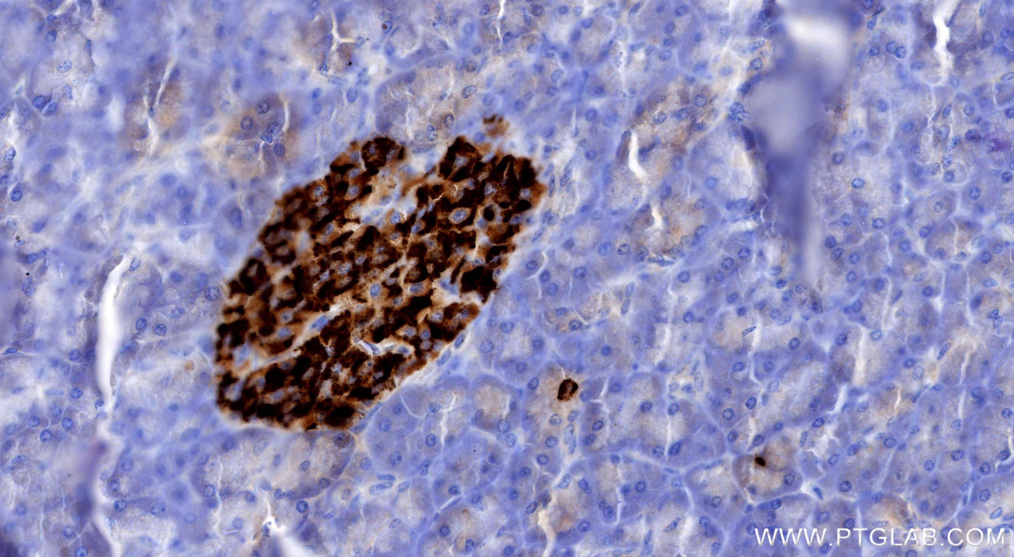 IHC staining of human pancreas using 98691-2-RR (same clone as 98691-2-PBS) Immunohistochemistry (IHC) staining of human pancreas tissue using Anti-Human TRPM5 Rabbit Recombinant Antibody (98691-2-RR)