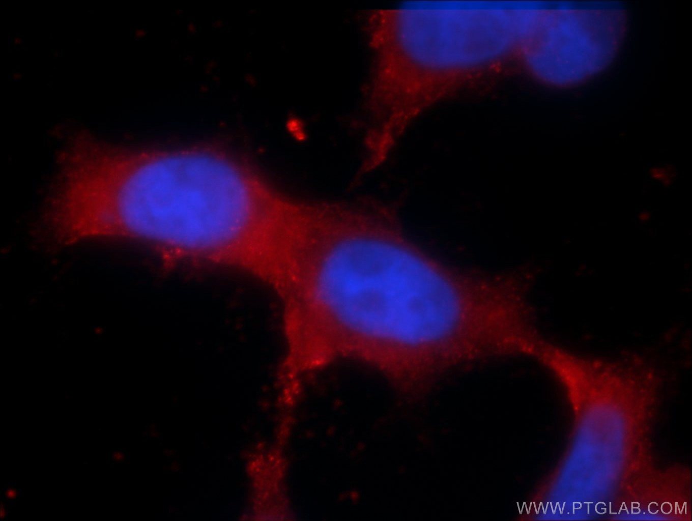 Immunofluorescence (IF) / fluorescent staining of HEK-293 cells using TRPM6 Polyclonal antibody (55455-1-AP)