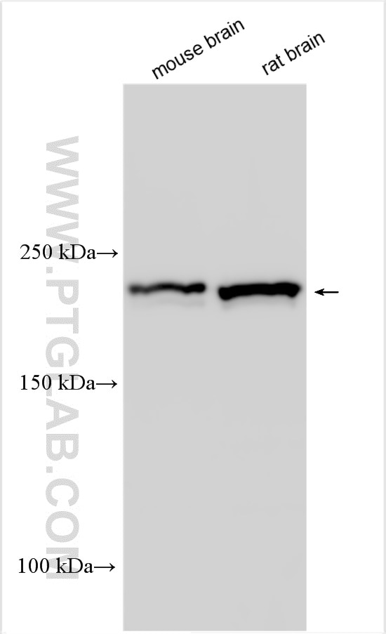 Western Blot (WB) analysis of various lysates using TRPM7 Polyclonal antibody (55251-1-AP)