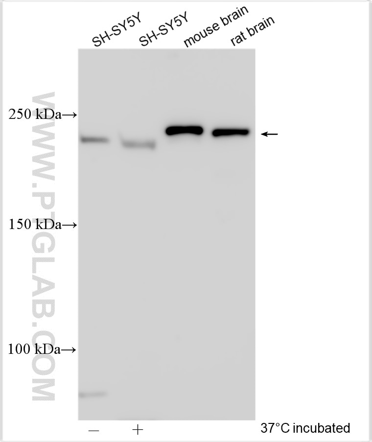 Western Blot (WB) analysis of various lysates using TRPM7 Polyclonal antibody (55251-1-AP)