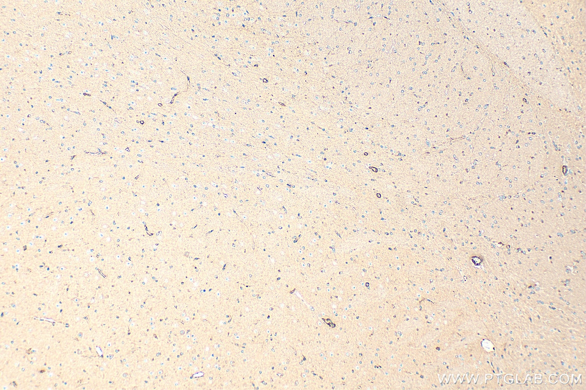 Immunohistochemistry (IHC) staining of mouse brain tissue using TRPM7 Recombinant monoclonal antibody (84324-1-RR)