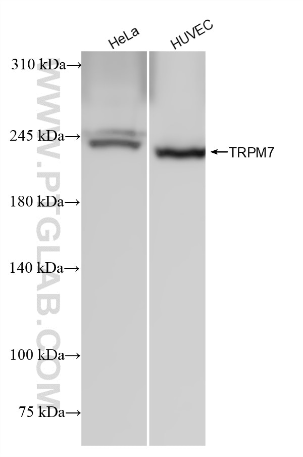Western Blot (WB) analysis of various lysates using TRPM7 Recombinant antibody (84324-1-RR)