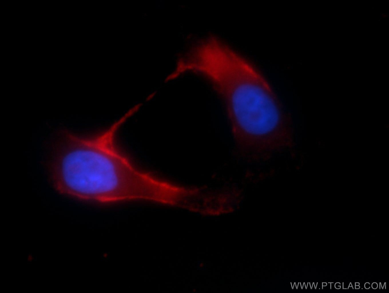 Immunofluorescence (IF) / fluorescent staining of SH-SY5Y cells using TRPM8 Polyclonal antibody (12813-1-AP)