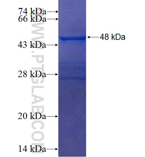 TRPM8 fusion protein Ag3483 SDS-PAGE