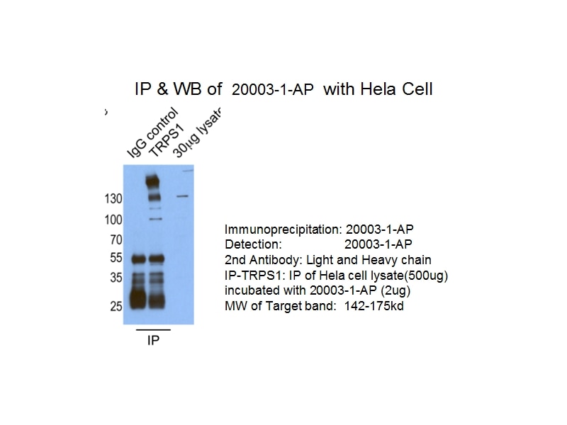 Immunoprecipitation (IP) experiment of HeLa cells using TRPS1 Polyclonal antibody (20003-1-AP)