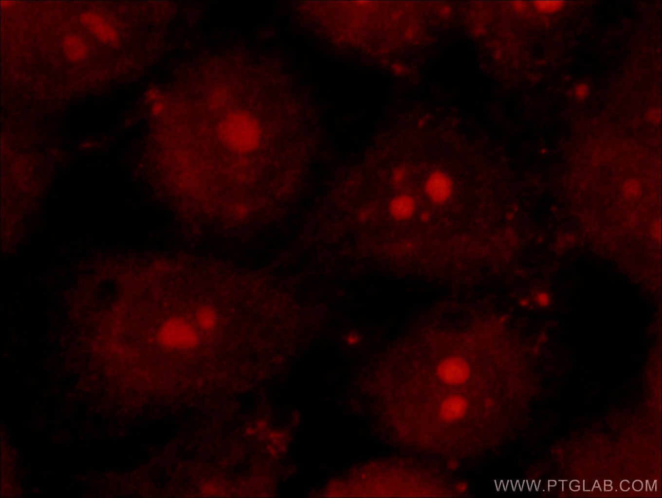 Immunofluorescence (IF) / fluorescent staining of HepG2 cells using TRPS1 Polyclonal antibody (20003-1-AP)