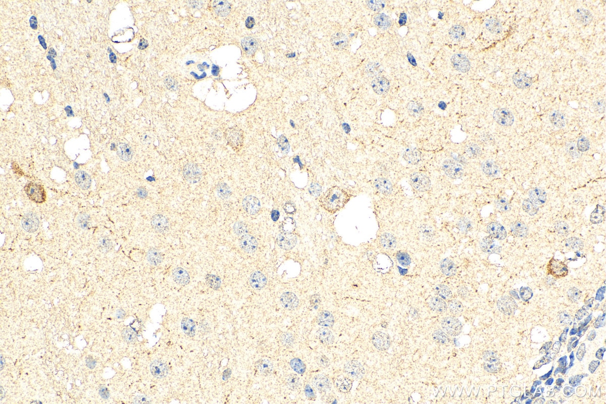 Immunohistochemistry (IHC) staining of mouse brain tissue using TRPS1 Polyclonal antibody (20003-1-AP)