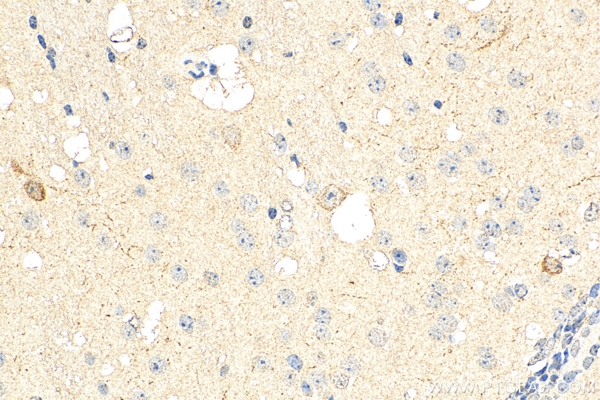 Immunohistochemistry (IHC) staining of mouse brain tissue using TRPS1 Polyclonal antibody (20003-1-AP)