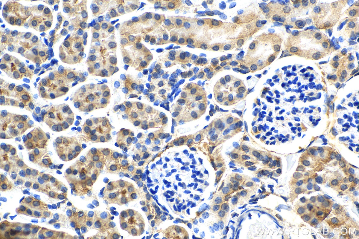 Immunohistochemistry (IHC) staining of mouse kidney tissue using TRPS1 Polyclonal antibody (20003-1-AP)