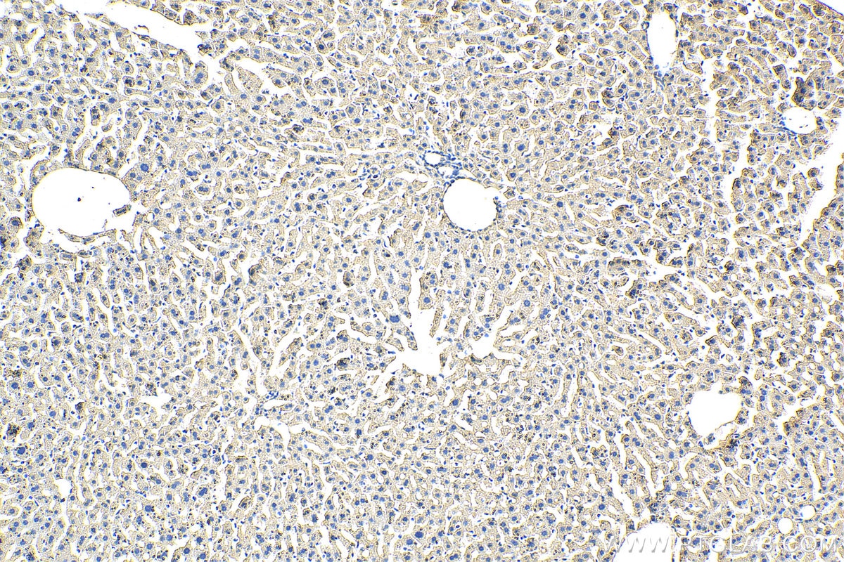 Immunohistochemistry (IHC) staining of mouse liver tissue using TRPS1 Polyclonal antibody (20003-1-AP)