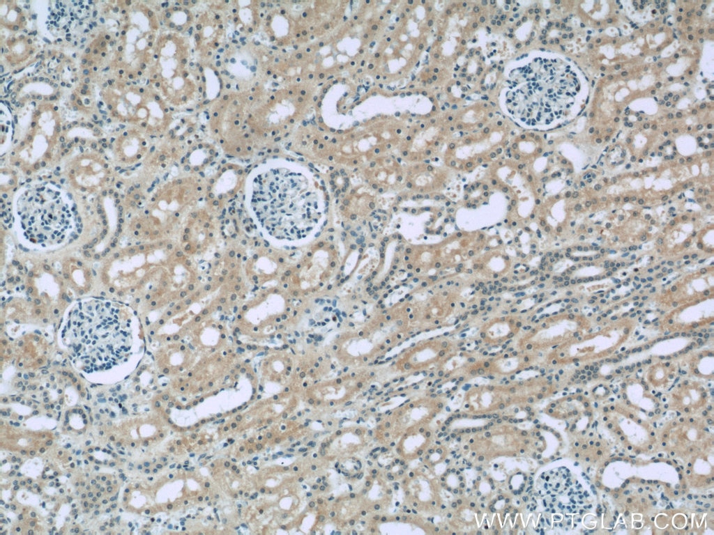 Immunohistochemistry (IHC) staining of human kidney tissue using TRPS1 Polyclonal antibody (20003-1-AP)