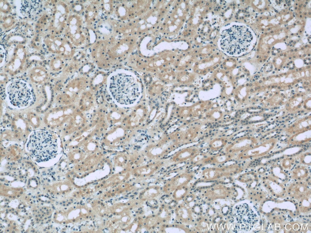 IHC staining of human kidney using 20003-1-AP