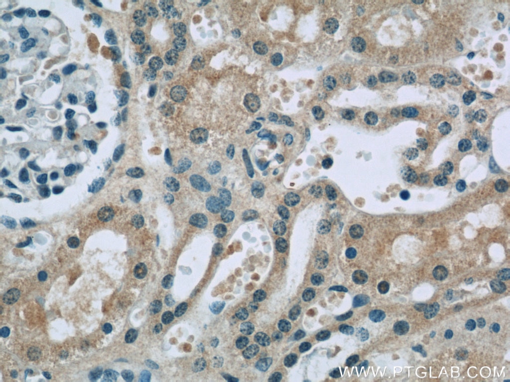 Immunohistochemistry (IHC) staining of human kidney tissue using TRPS1 Polyclonal antibody (20003-1-AP)