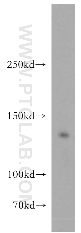 Western Blot (WB) analysis of mouse kidney tissue using TRPS1 Polyclonal antibody (20003-1-AP)