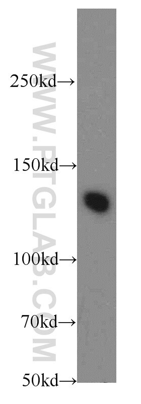 Western Blot (WB) analysis of mouse brain tissue using TRPS1 Polyclonal antibody (20003-1-AP)