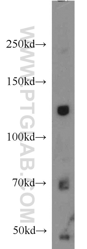 Western Blot (WB) analysis of mouse brain tissue using TRPS1 Polyclonal antibody (20003-1-AP)