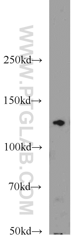 Western Blot (WB) analysis of rat brain tissue using TRPS1 Polyclonal antibody (20003-1-AP)