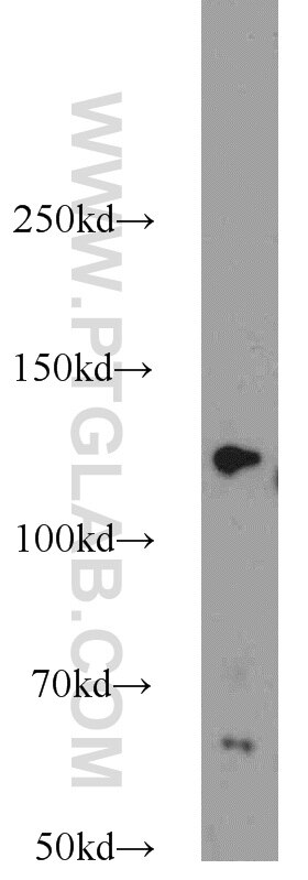 Western Blot (WB) analysis of rat brain tissue using TRPS1 Polyclonal antibody (20003-1-AP)