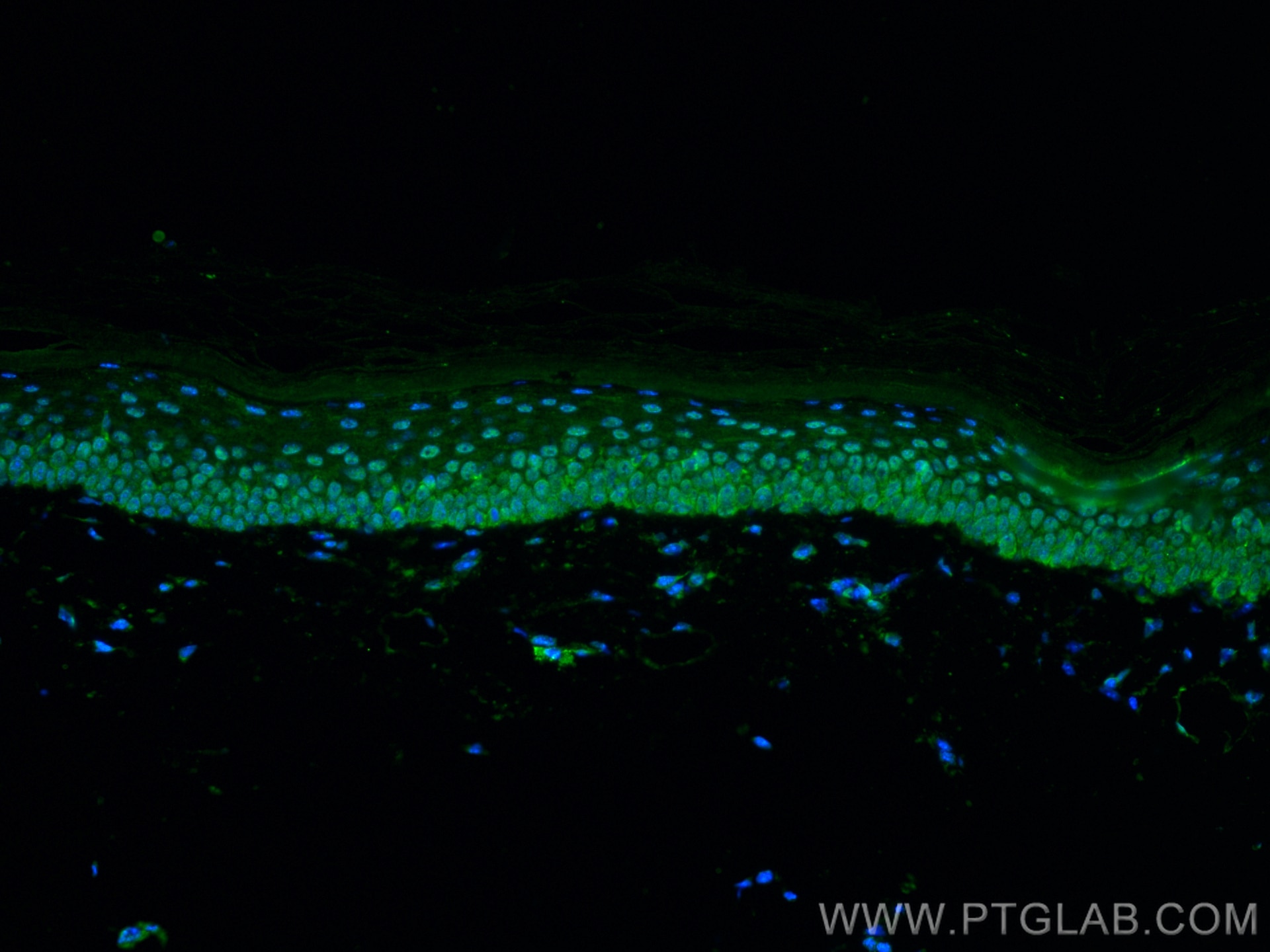 Immunofluorescence (IF) / fluorescent staining of mouse skin tissue using TRPS1 Polyclonal antibody (21938-1-AP)