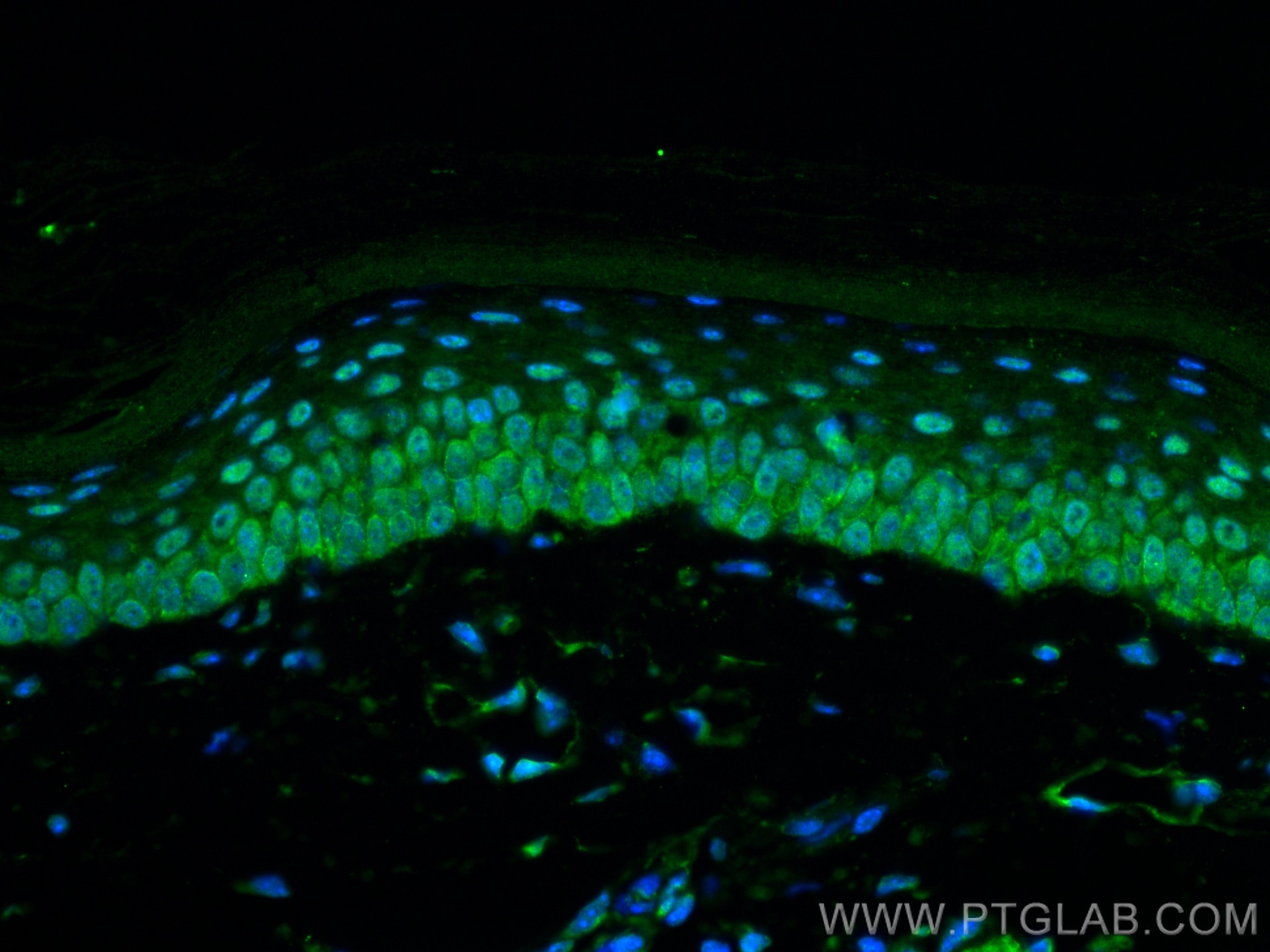 Immunofluorescence (IF) / fluorescent staining of mouse skin tissue using TRPS1 Polyclonal antibody (21938-1-AP)