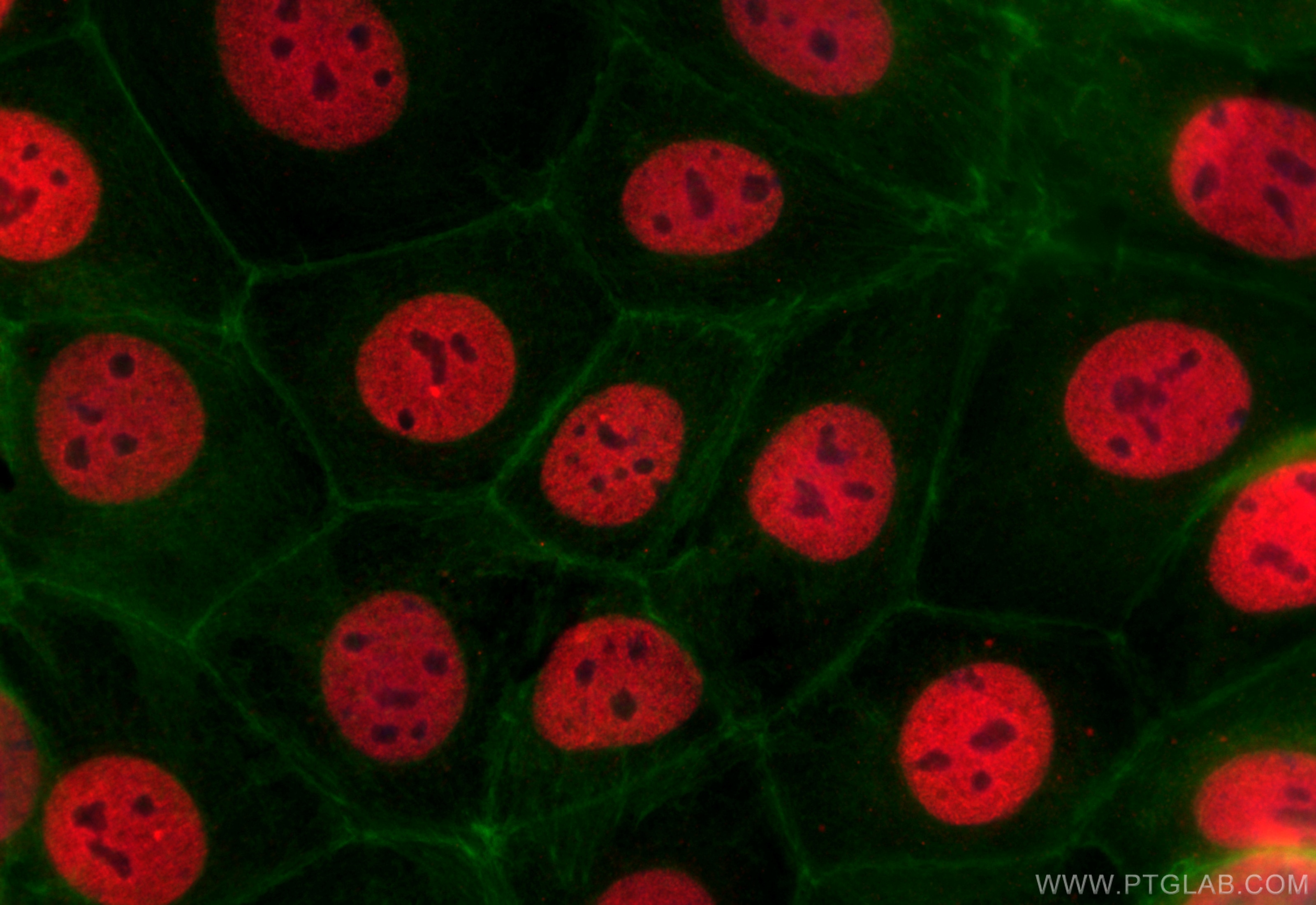 Immunofluorescence (IF) / fluorescent staining of MCF-7 cells using TRPS1 Polyclonal antibody (21938-1-AP)