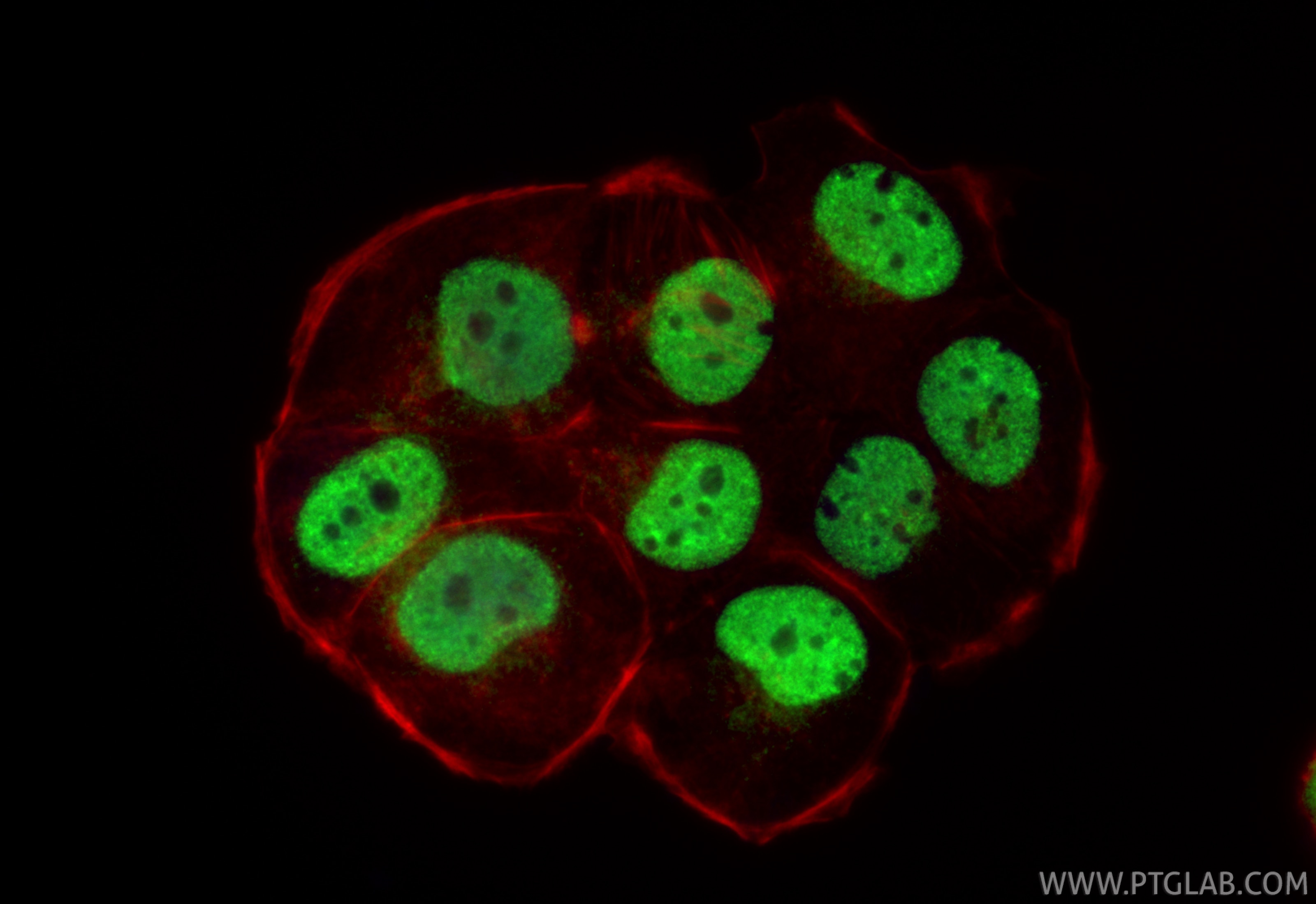 Immunofluorescence (IF) / fluorescent staining of T-47D cells using TRPS1 Polyclonal antibody (21938-1-AP)