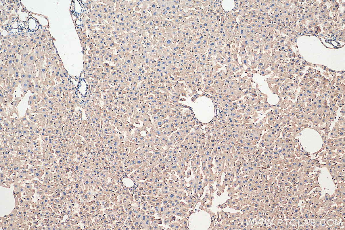 Immunohistochemistry (IHC) staining of mouse liver tissue using TRPS1 Polyclonal antibody (21938-1-AP)
