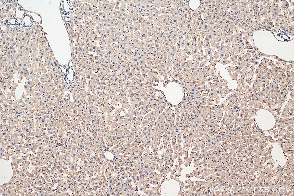 Immunohistochemistry (IHC) staining of mouse liver tissue using TRPS1 Polyclonal antibody (21938-1-AP)