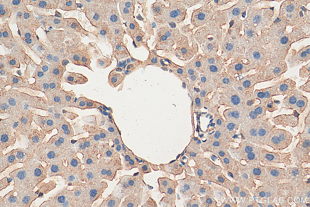 Immunohistochemistry (IHC) staining of mouse liver tissue using TRPS1 Polyclonal antibody (21938-1-AP)