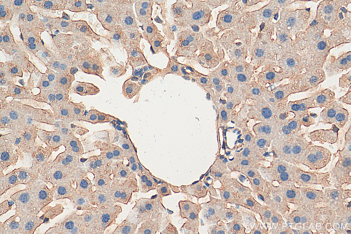 Immunohistochemistry (IHC) staining of mouse liver tissue using TRPS1 Polyclonal antibody (21938-1-AP)