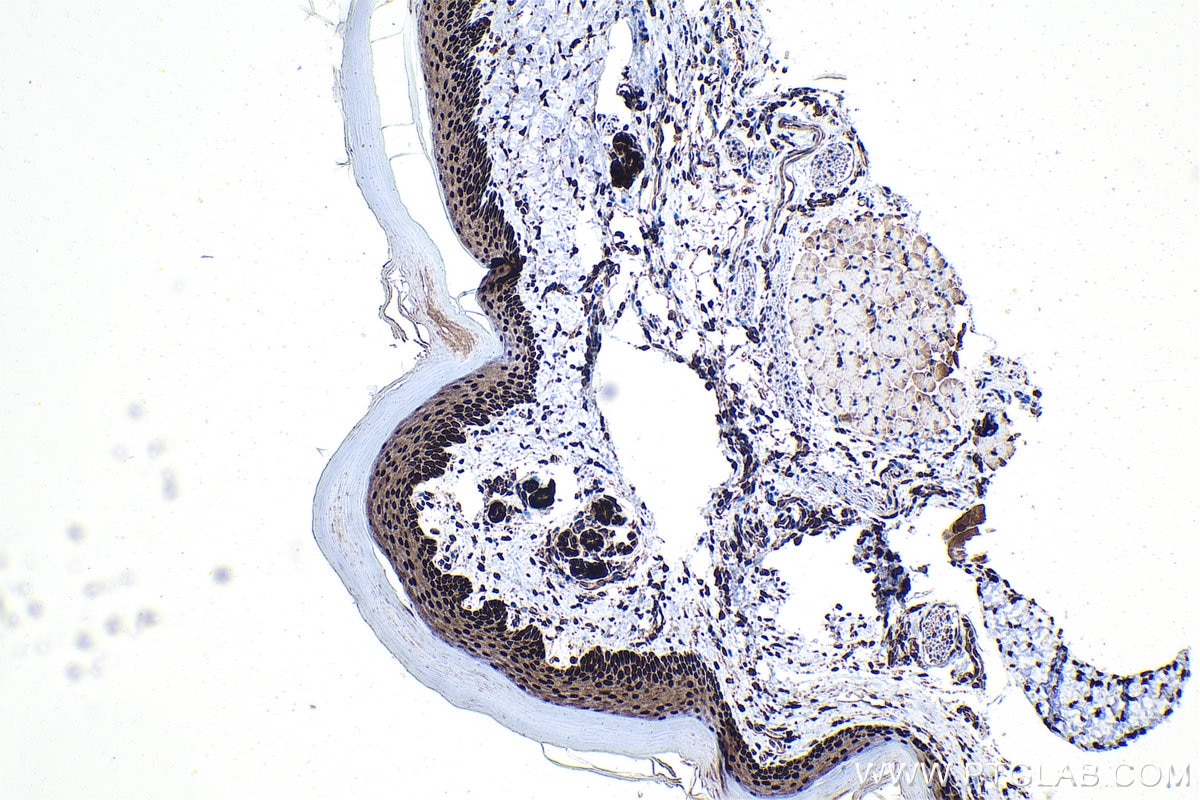 Immunohistochemistry (IHC) staining of mouse skin tissue using TRPS1 Polyclonal antibody (21938-1-AP)