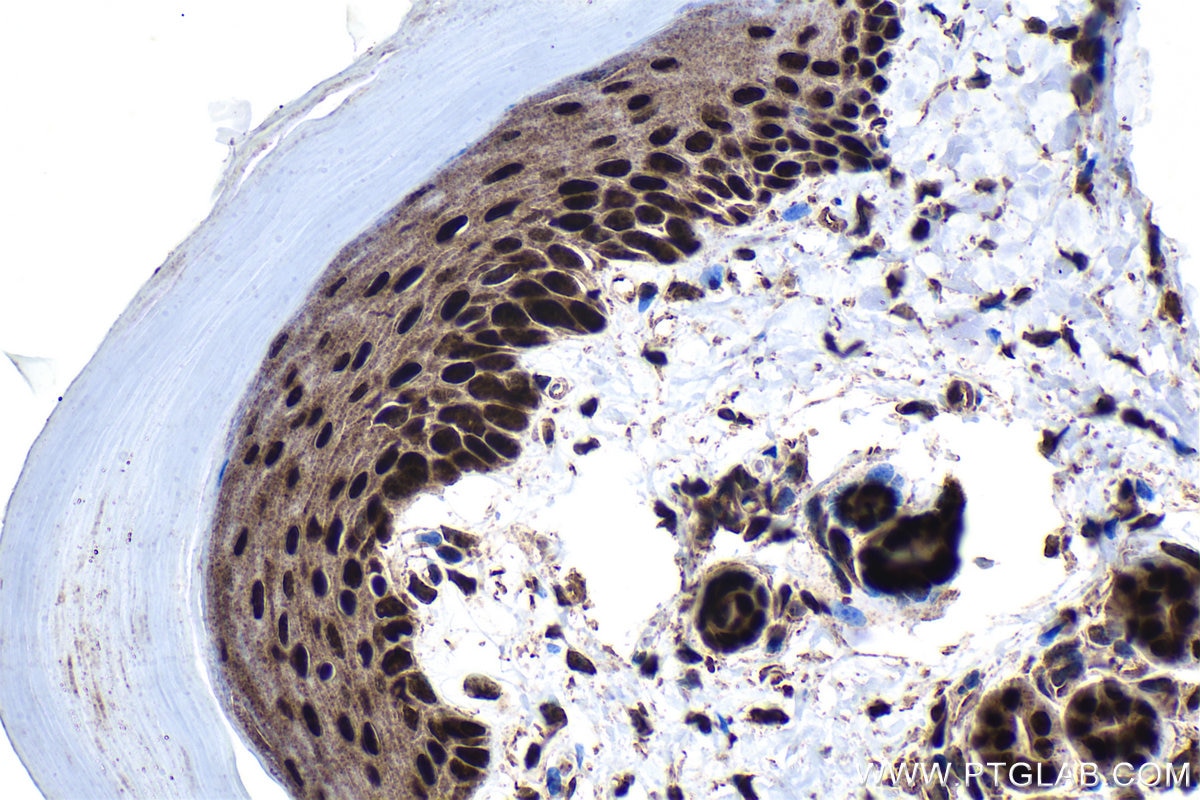 Immunohistochemistry (IHC) staining of mouse skin tissue using TRPS1 Polyclonal antibody (21938-1-AP)