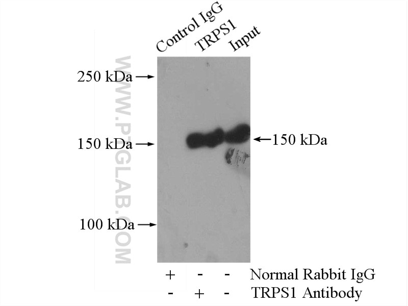 Immunoprecipitation (IP) experiment of mouse lung tissue using TRPS1 Polyclonal antibody (21938-1-AP)