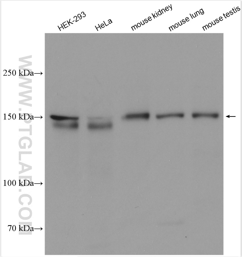 Western Blot (WB) analysis of various lysates using TRPS1 Polyclonal antibody (21938-1-AP)