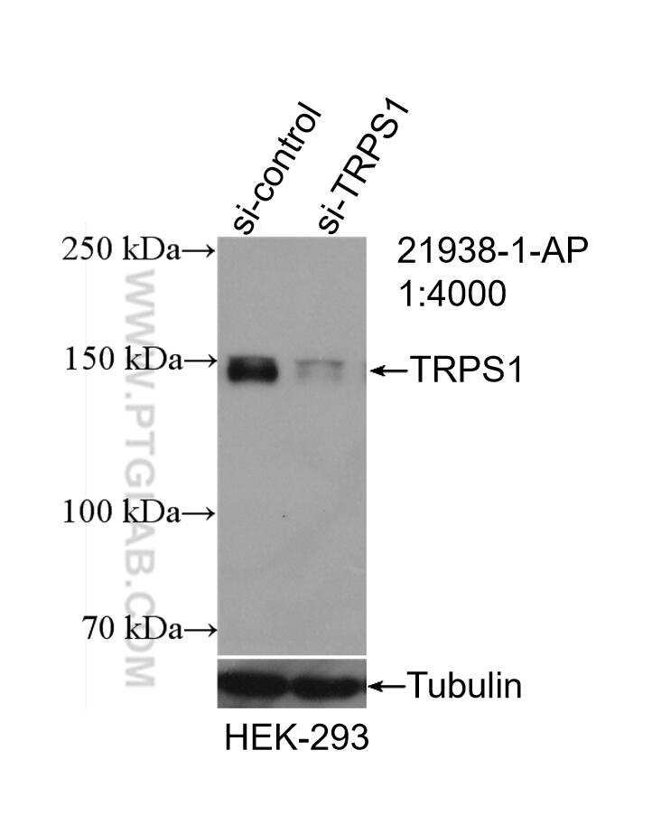 Western Blot (WB) analysis of HEK-293 cells using TRPS1 Polyclonal antibody (21938-1-AP)