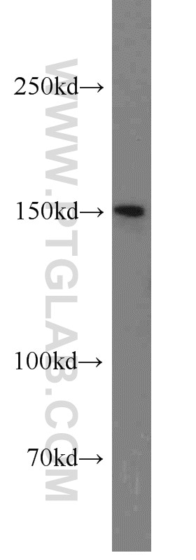 Western Blot (WB) analysis of HeLa cells using TRPS1 Polyclonal antibody (21938-1-AP)