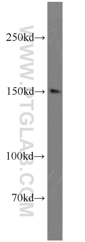 Western Blot (WB) analysis of HEK-293 cells using TRPS1 Polyclonal antibody (21938-1-AP)