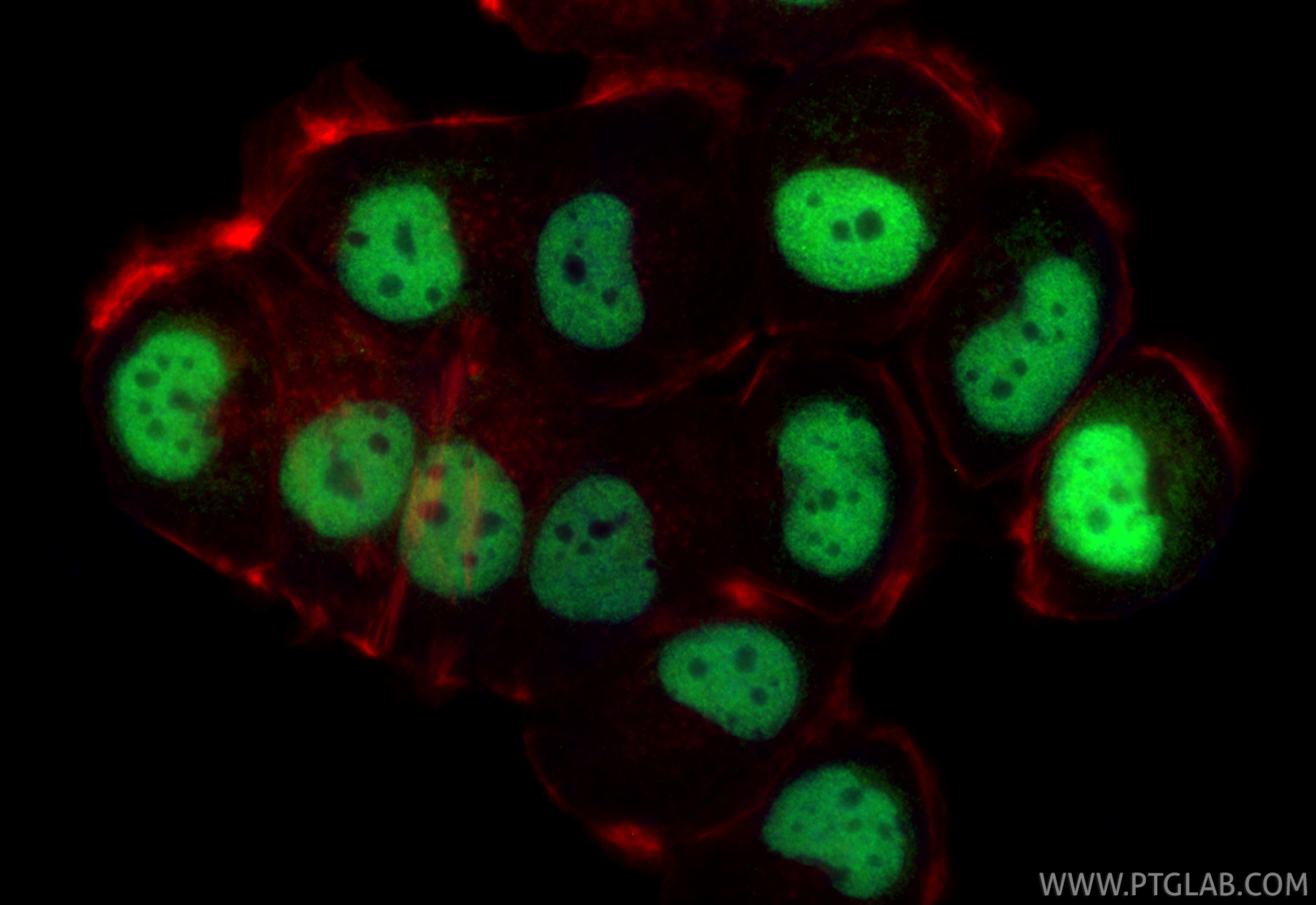 IF Staining of T-47D using 28753-1-AP Immunofluorescence (IF) / fluorescent staining of T-47D cells using TRPS1 Polyclonal antibody (28753-1-AP)