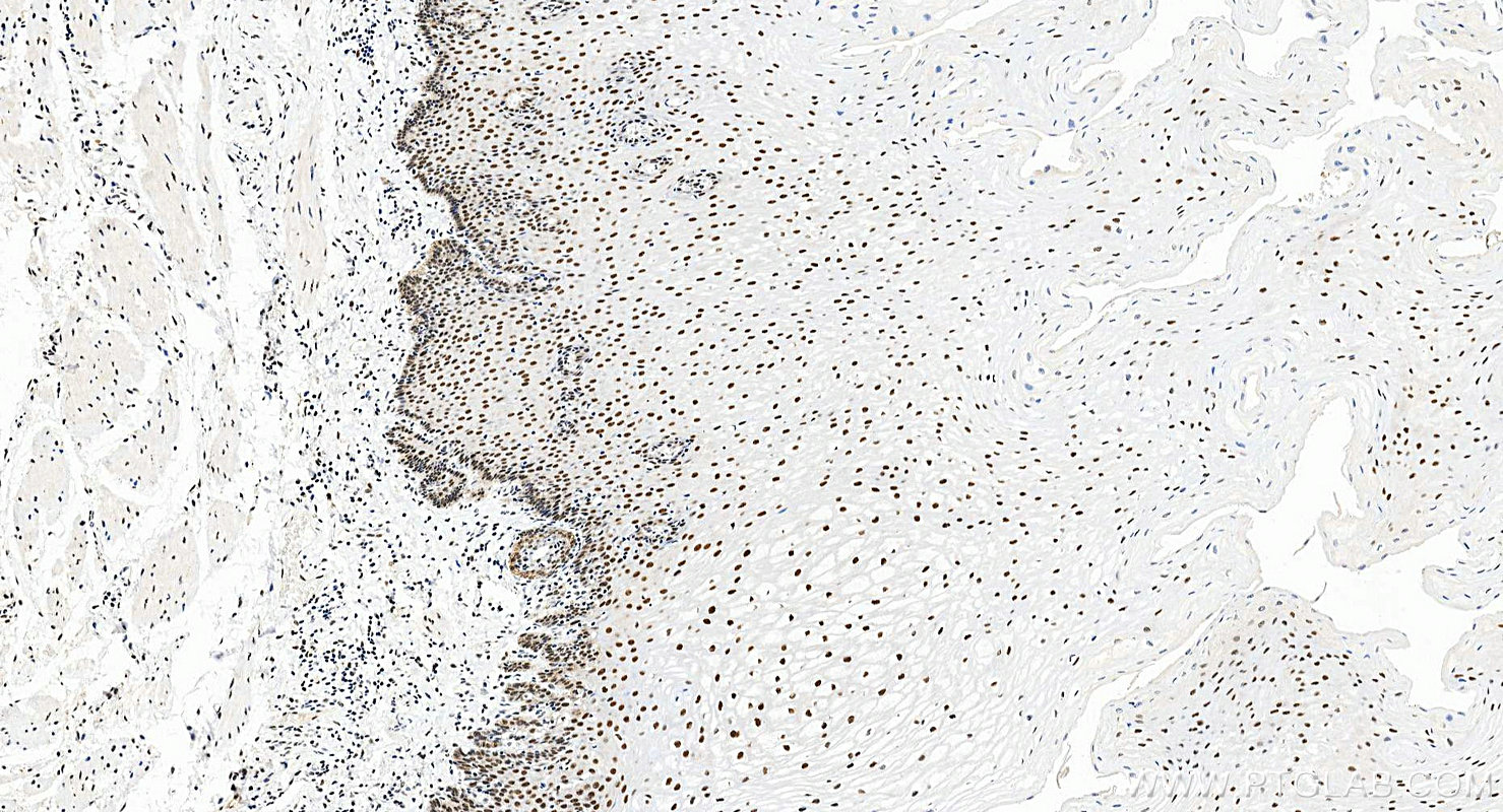 IHC staining of human oesophagus using 28753-1-AP Immunohistochemistry (IHC) staining of human oesophagus tissue using TRPS1 Polyclonal antibody (28753-1-AP)