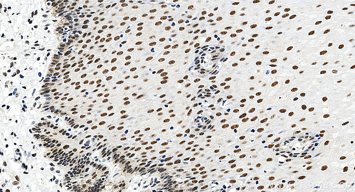 IHC staining of human oesophagus using 28753-1-AP Immunohistochemistry (IHC) staining of human oesophagus tissue using TRPS1 Polyclonal antibody (28753-1-AP)