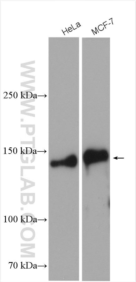 Western Blot (WB) analysis of various lysates using TRPS1 Polyclonal antibody (28753-1-AP)