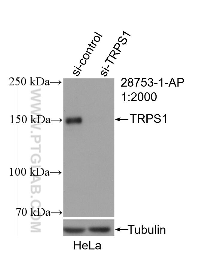 Western Blot (WB) analysis of HeLa cells using TRPS1 Polyclonal antibody (28753-1-AP)