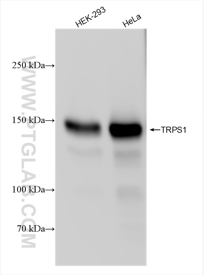 Western Blot (WB) analysis of various lysates using TRPS1 Recombinant antibody (83062-4-RR)