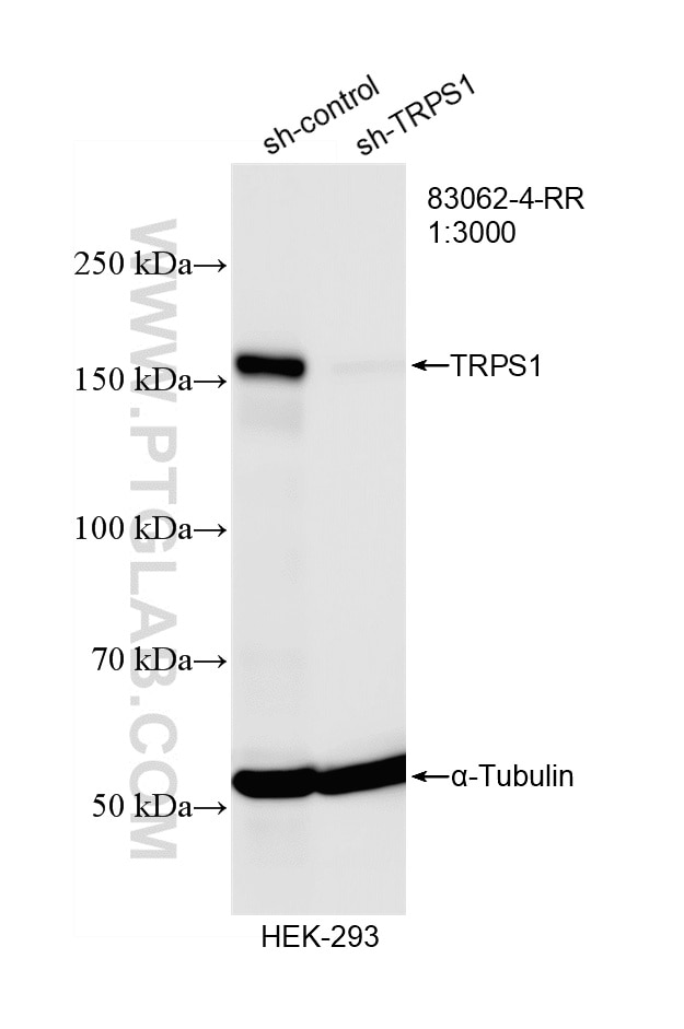 WB result of TRPS1 antibody (83062-4-RR; 1:3000; incubated at room temperature for 1.5 hours) with sh-Control and sh-TRPS1 transfected HEK-293 cells. Western Blot (WB) analysis of HEK-293 cells using TRPS1 Recombinant monoclonal antibody (83062-4-RR)